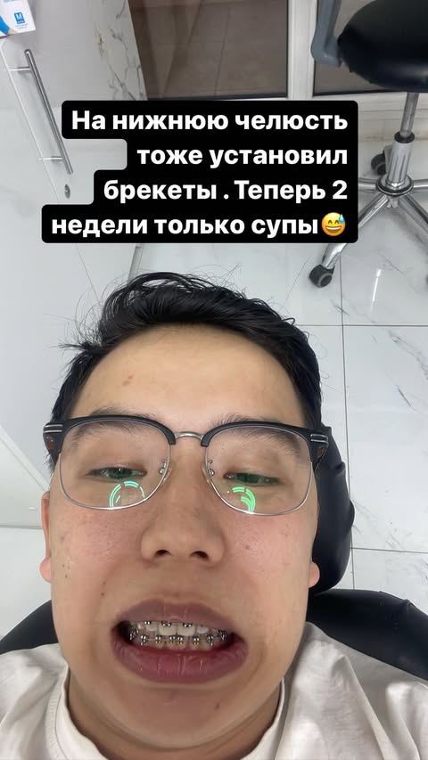 Удаление зубов