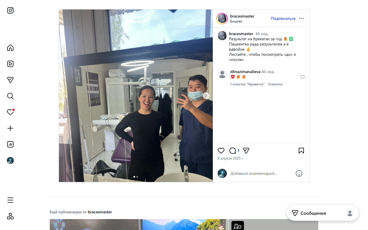 Брекеты — до